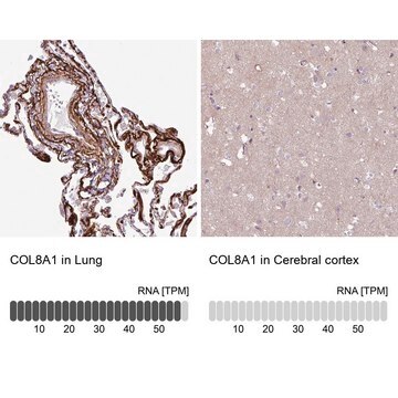 Anti-COL8A1 antibody produced in rabbit Prestige Antibodies&#174; Powered by Atlas Antibodies, affinity isolated antibody, buffered aqueous glycerol solution