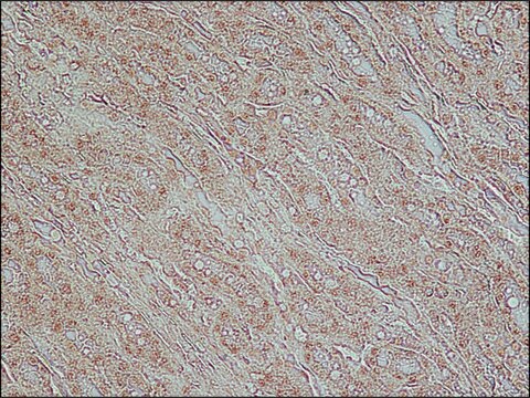 Anti-TDP-43 (C-terminal) antibody produced in rabbit ~1.0&#160;mg/mL, affinity isolated antibody, buffered aqueous solution