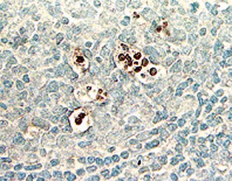 ApopTag Plus Peroxidase In-Situ-Apoptose-Kit The ApopTag Plus Peroxidase In Situ Apoptosis Detection Kit detects apoptotic cells by labeling &amp; detecting DNA strand breaks by the indirect TUNEL method.