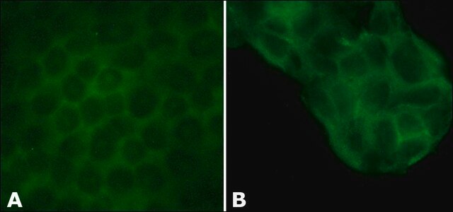 Anti-l/s-Afadin antibody produced in rabbit affinity isolated antibody