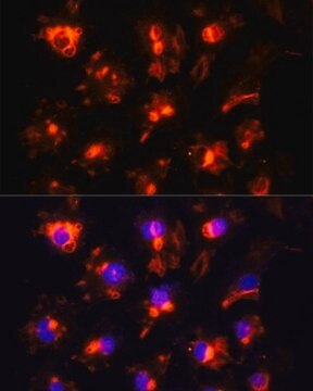 Anti-CD31 antibody produced in rabbit