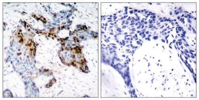 Anti-Estrogen Receptor-&#945; antibody produced in rabbit affinity isolated antibody