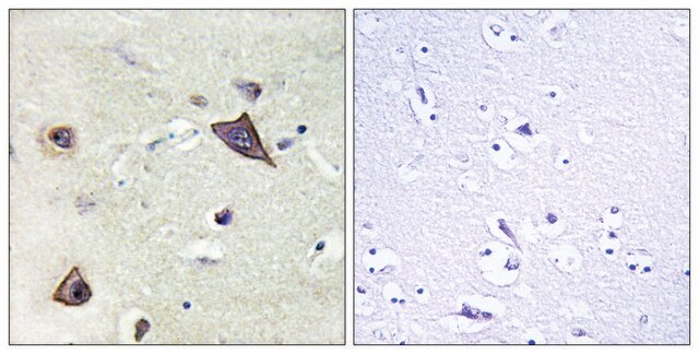 Anti-NMDAR1 antibody produced in rabbit affinity isolated antibody