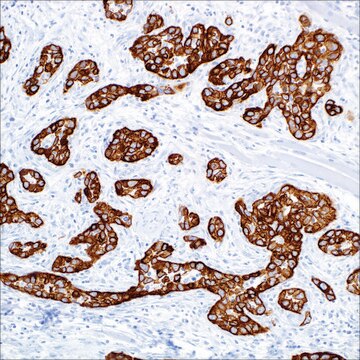 Cytokeratin&nbsp;5 (EP1601Y) + Cytokeratin&nbsp;14 (LL002) Mouse/Rabbit Monoclonal Antibodies Mouse and Rabbit Monoclonal Antibody