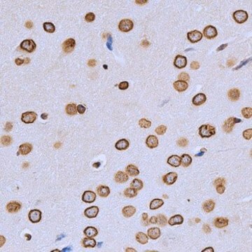 Anti-Lamin A/C antibody produced in rabbit