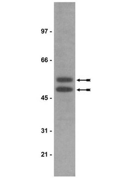 Anti-Phospho-GSK3(Tyr279/Tyr216)-Antikörper, Klon 5G-2F clone 5G-2F, Upstate&#174;, from mouse