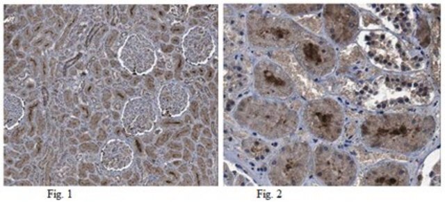 Anti-CCN1/CYR61 Antibody from rabbit, purified by affinity chromatography