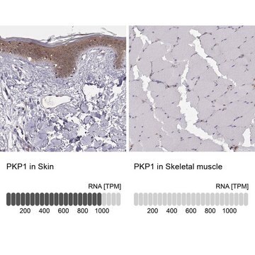 Anti-PKP1 antibody produced in rabbit Prestige Antibodies&#174; Powered by Atlas Antibodies, affinity isolated antibody, buffered aqueous glycerol solution, ab1