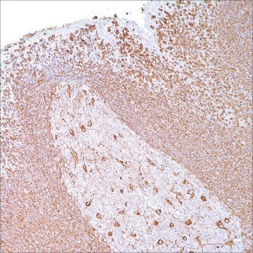 Vimentin (V9) Mouse Monoclonal Antibody