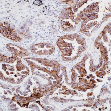 Napsin&nbsp;A (MRQ-60) Mouse Monoclonal Antibody