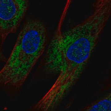 Anti-OMD antibody produced in rabbit Prestige Antibodies&#174; Powered by Atlas Antibodies, affinity isolated antibody