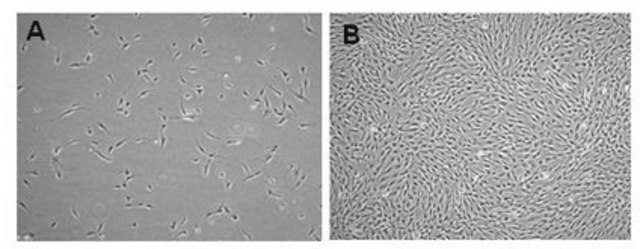 Mesenchymale Stammzellen aus menschlichem Fettgewebe Human Adipose Mesenchymal Stem Cells (MSCs) are isolated from human adipose tissue and are cryopreserved at P2 to ensure optimal phenotype and the highest viability and plating efficiency.