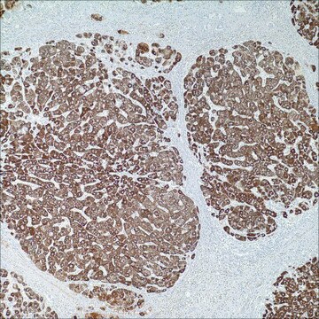 Hepatocyte Specific Antigen (Hep Par-1) (OCH1E5) Mouse Monoclonal Antibody