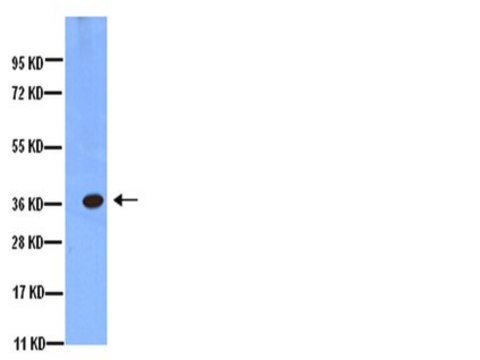 Anti-Aquaporin-4-Antikörper, C-Terminus Chemicon&#174;, from rabbit