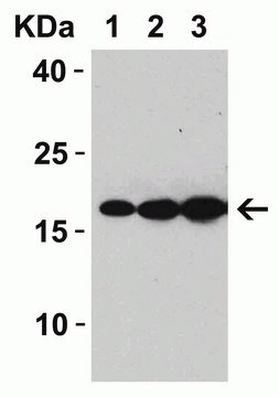 Anti-SARS-CoV Matrix antibody produced in rabbit affinity isolated antibody