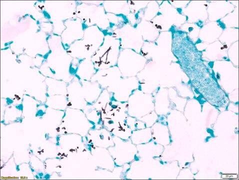 Fungi TISSUE-TROL&#8482; Control Slides from mouse lung containing Candida albicans