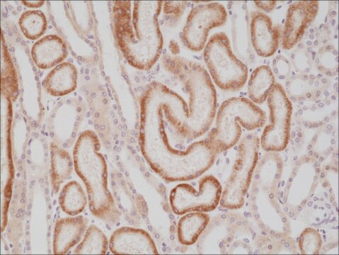 Anti-p504s/AMACR antibody, Rabbit monoclonal recombinant, expressed in HEK 293 cells, clone RM349, purified immunoglobulin