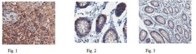 Anti-Caspase 1 Antibody from rabbit, purified by affinity chromatography