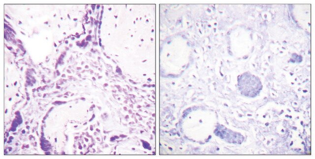 Anti-PPAR-&#947; antibody produced in rabbit affinity isolated antibody