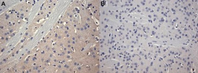 Anti-Adenosine Receptor A2a Antibody, clone 7F6-G5-A2 clone 7F6-G5-A2, Upstate&#174;, from mouse