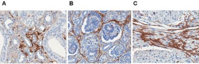 Anti-Laminin-5 Antibody, clone P3E4 clone P3E4, Chemicon&#174;, from mouse