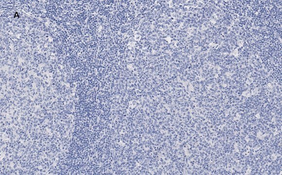 Anti-NF-kB p50/105 Antibody, clone 1N19, ZooMAb&#174; Rabbit Monoclonal recombinant, expressed in HEK 293 cells