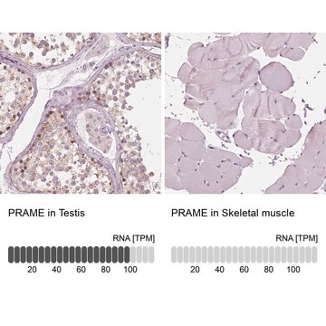 Anti-PRAME antibody produced in rabbit Prestige Antibodies&#174; Powered by Atlas Antibodies, affinity isolated antibody, buffered aqueous glycerol solution