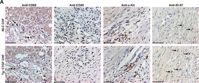 Anti-Ki-67 Antibody Chemicon&#174;, from rabbit