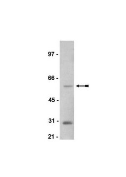 Anti-SGK1 Antibody Upstate&#174;, from rabbit