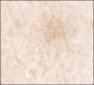 Anti-FGFR3 antibody produced in rabbit affinity isolated antibody