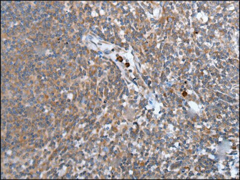 Anti-WISP2 affinity isolated antibody