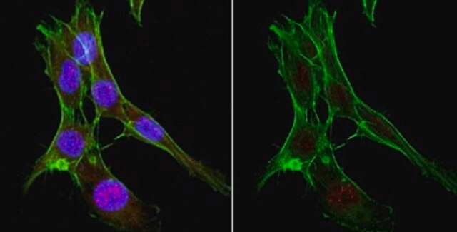 Anti-Cas9 Antibody, NT Antibody, clone 8C1-F10 clone 8C1-F10, from mouse