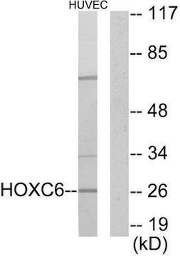 Anti-HOXC6 antibody produced in rabbit affinity isolated antibody