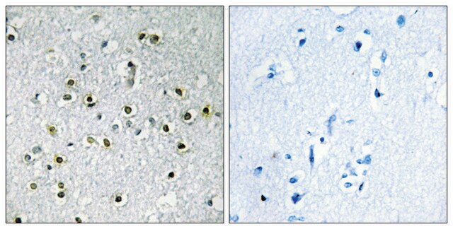 Anti-TFE3 antibody produced in rabbit affinity isolated antibody