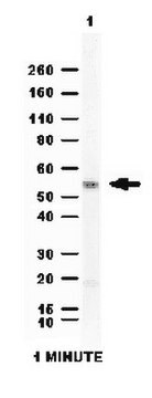 Anti-Aldehyde dehydrogenase 1 (ALDH1A1) Antibody from rabbit, purified by affinity chromatography