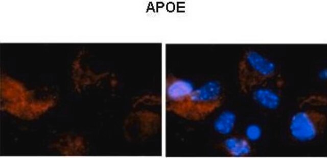 Anti-APOE (N-terminal) antibody produced in rabbit affinity isolated antibody