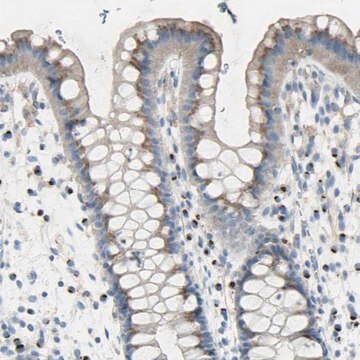 Anti-B4GALT3 antibody produced in rabbit Prestige Antibodies&#174; Powered by Atlas Antibodies, affinity isolated antibody, buffered aqueous glycerol solution