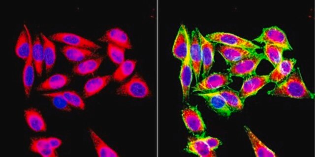 Anti-Vimentin Antibody, clone VIM 3B4 clone VIM 3B4, Chemicon&#174;, from mouse