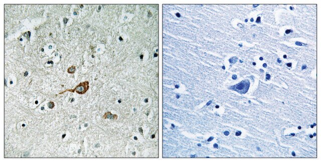 Anti-C-ABL antibody produced in rabbit affinity isolated antibody