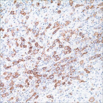 CD30 (Ber-H2) Mouse Monoclonal Antibody