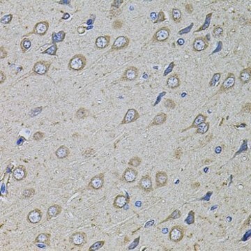 Anti-COL1A2 antibody produced in rabbit