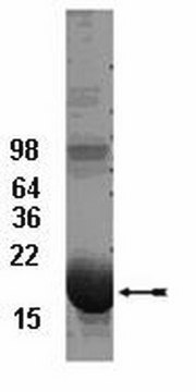 UbcH5b Conjugating Enzyme, 100 &#181;g The His6-tagged fusion protein of UbcH5b is charge &amp; support ubiquitinylation in vitro. The His6-tagged UbcH5 family members all appear to form thiol ester conjugates with ubiquitin at a similar rate under similar conditions.