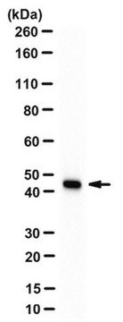 Anti-Aktin, Glattmuskel-Antikörper, Klon ASM-1/1A4 clone ASM-1 (1A4), from mouse