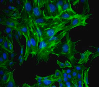 AT-3 Mouse Mammary Carcinoma Cell Line AT-3 mouse mammary tumor cell line may be used to develop mouse models for mammary cancer studies.