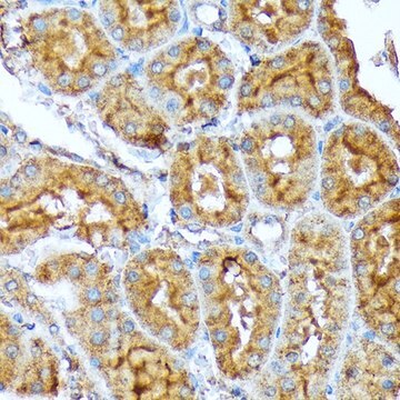 Anti-ACC1 antibody produced in rabbit