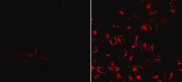 BioTracker-555-Lysosom-Farbstoff, UV-Anregung, rot Live cell imaging dye for acidic cellular organelles such as lysosomes.