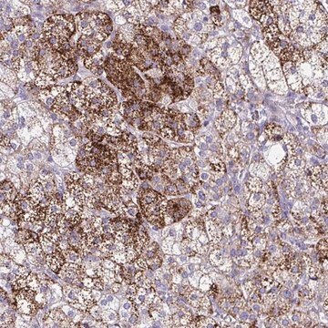 Anti-SREBF1 antibody produced in rabbit Prestige Antibodies&#174; Powered by Atlas Antibodies, affinity isolated antibody, buffered aqueous glycerol solution