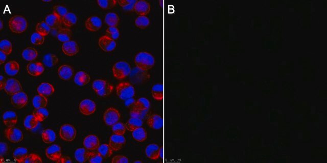 Anti-Influenza A Antibody, nucleoprotein, clone A1 clone A1, Chemicon&#174;, from mouse