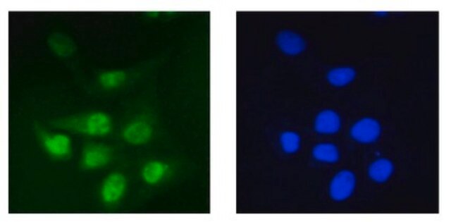 Anti-PP2A reg. subunit B56 epsilon (PPP2R5E) Antibody, clone 5A5-1F3 clone 5A5-1F3, from mouse