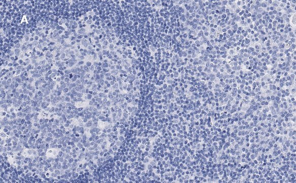 Anti-Calnexin Antibody, clone 10N19, ZooMAb&#174; Rabbit Monoclonal recombinant, expressed in HEK 293 cells